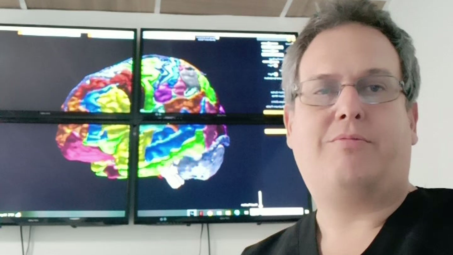 Áreas de Brodmann